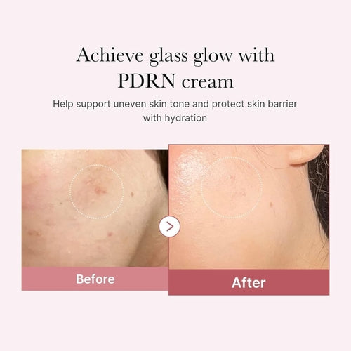 Medicube PDRN Pink Hyaluronic Moisturizing Cream